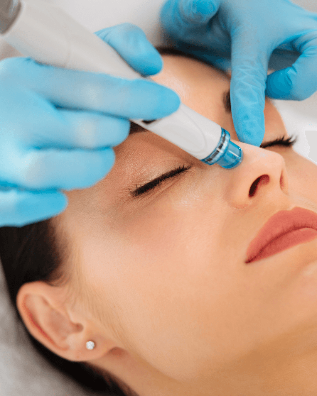 Aquafacial Gesichtsbehandlung Heilbronn — C&C Beauty