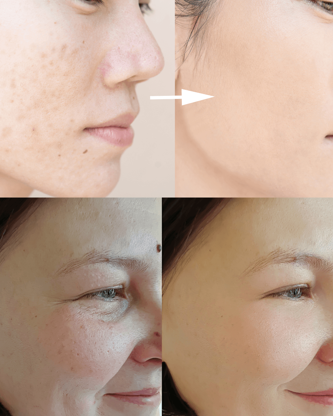 Poren → Verfeinert & Strahlend — Aquafacial Heilbronn C&C Beauty