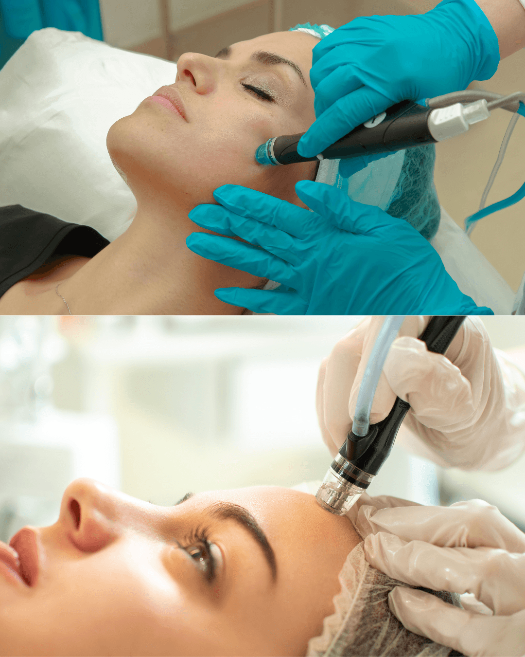 Aquafacial Behandlung Nahaufnahme Heilbronn — C&C Beauty