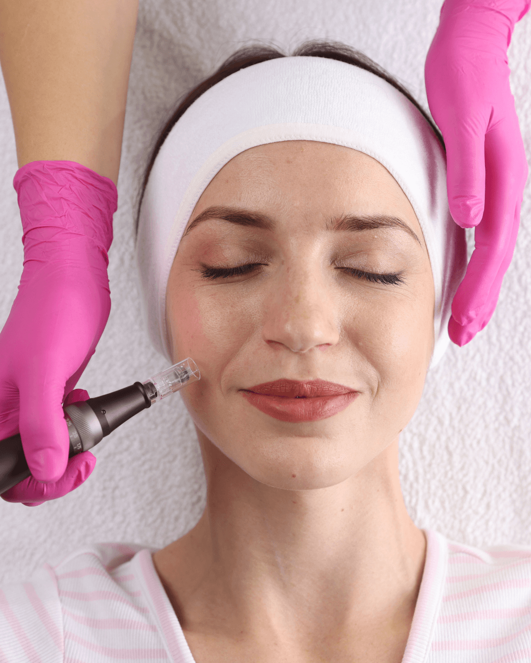 Microneedling Hautverjüngung Heilbronn — C&C Beauty