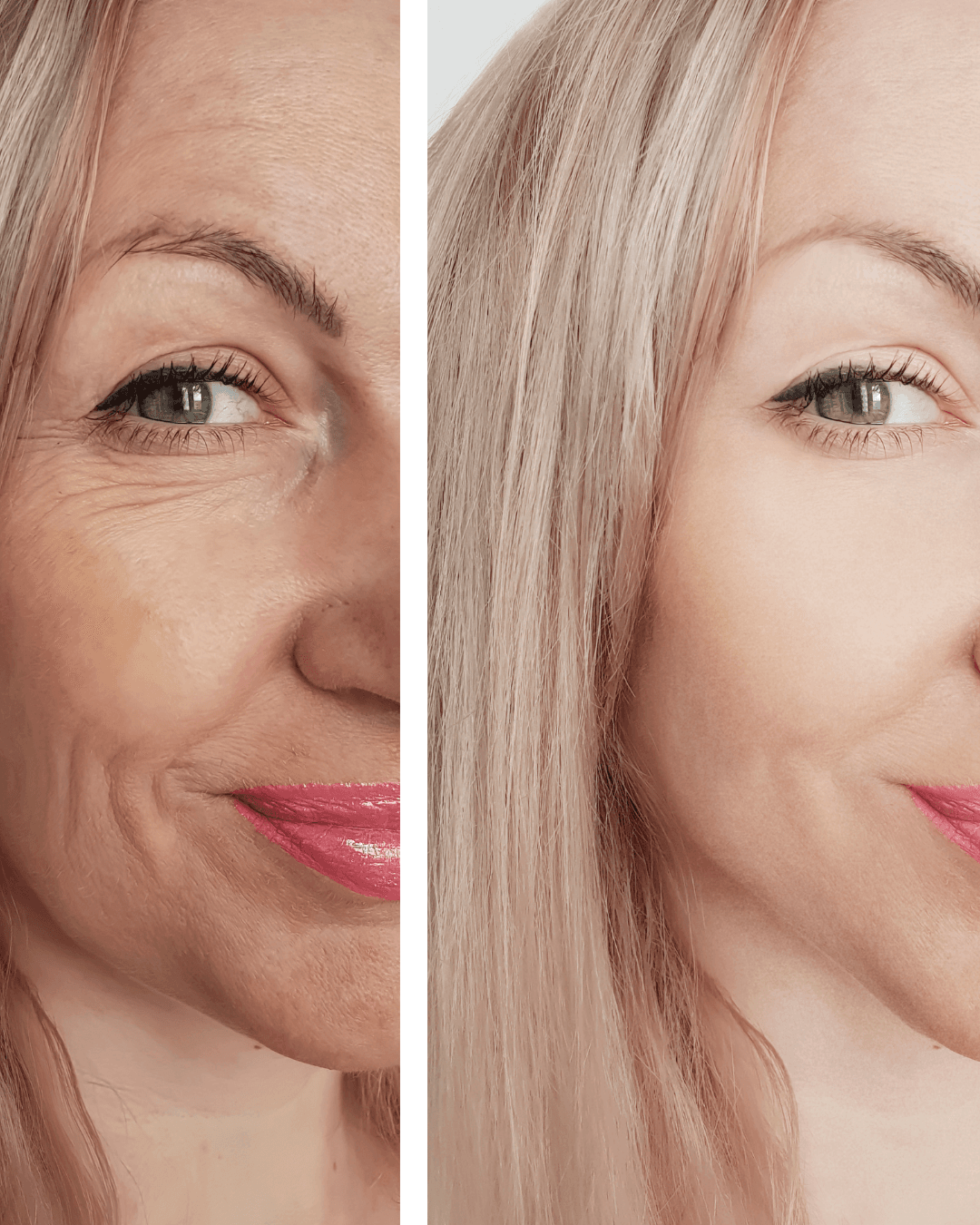 Anti-Aging · Fältchen reduziert