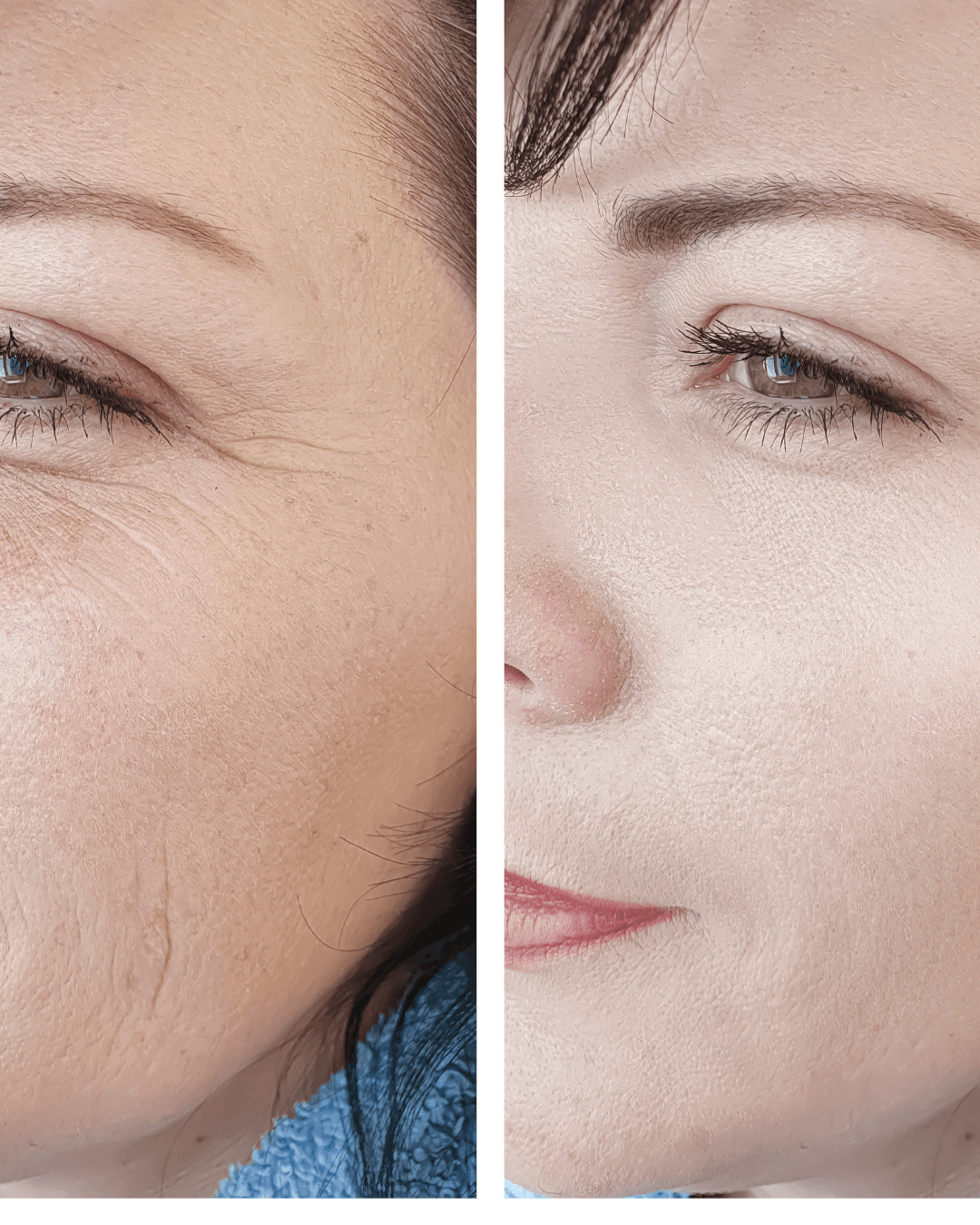 Hauterneuerung · Glow & Straffung — Microneedling Heilbronn C&C Beauty