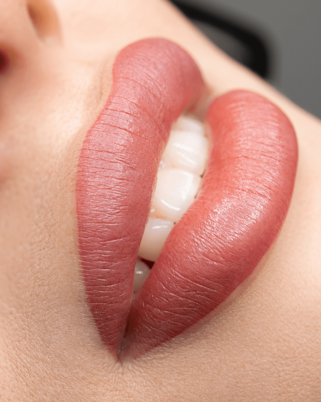 PMU Lippen Ergebnis Heilbronn